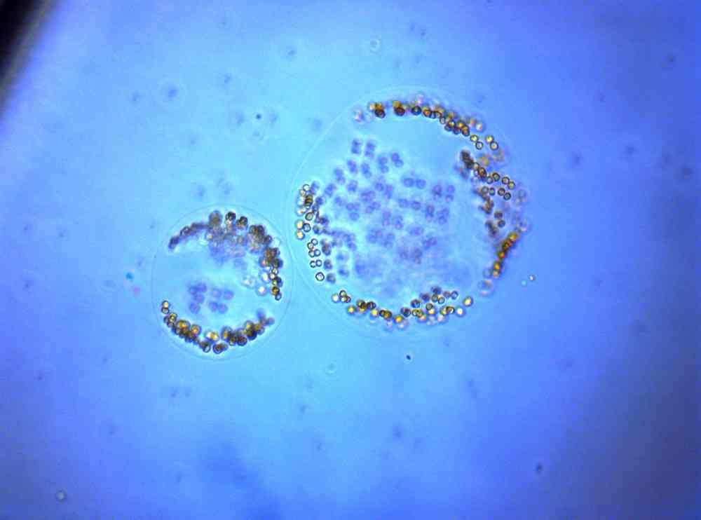 Phaeocystis pouchetii. Ill.: UiT.